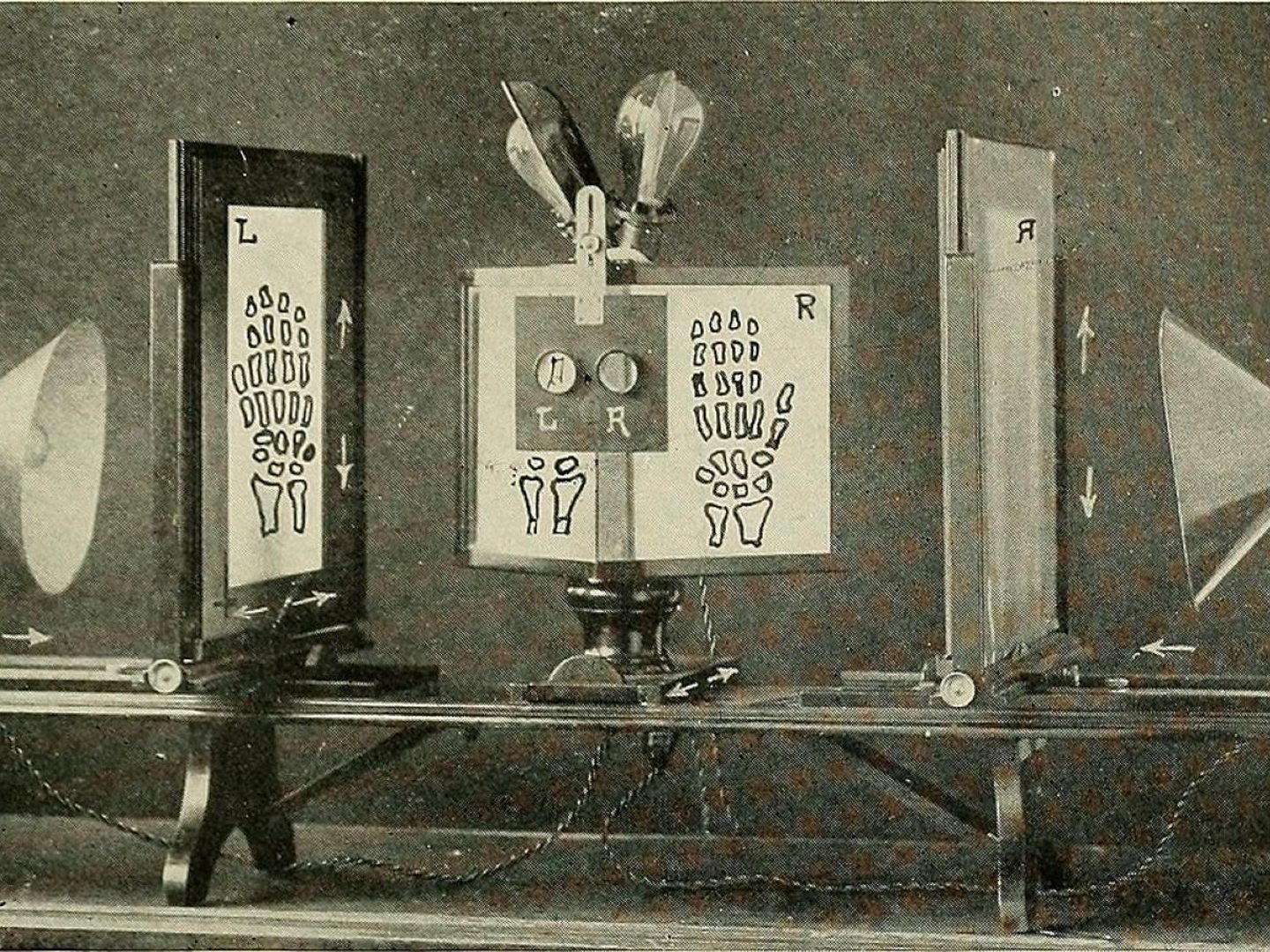 A historic illustration of a stereoscope. It comprises a complex arrangement of lamps and screens on which are visible the bones of the hand. A viewer with 2 lenses marked 'L' and 'R' for 'left' and 'right' is in the middle of the stereoscope.